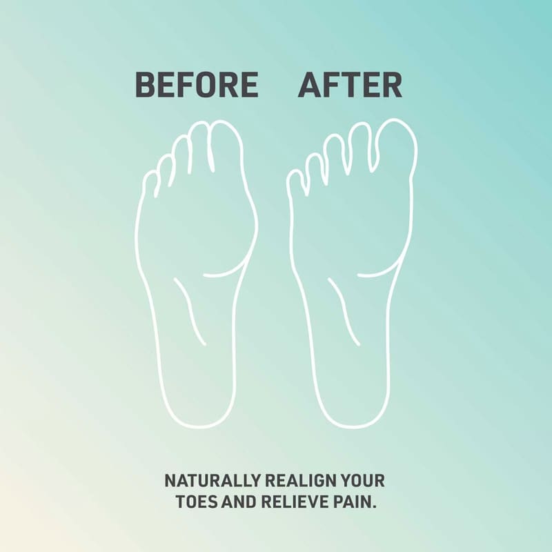 Toe Spreader Sidekick